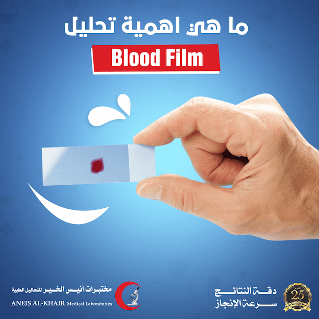 سعر تحليل Blood Film